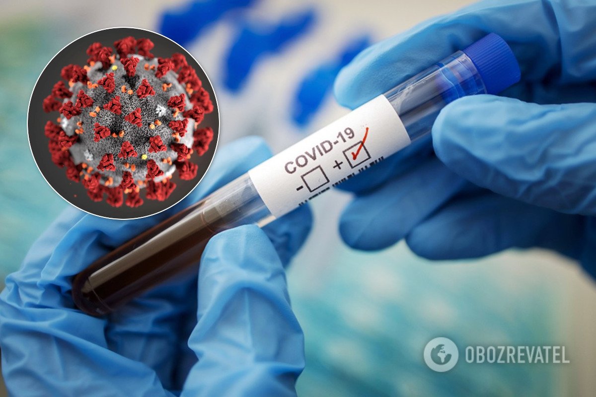 Спалаху COVID-19 в Україні немає, відкрилася реальна ситуація: інфекціоністи пояснили різке зростання захворюваності