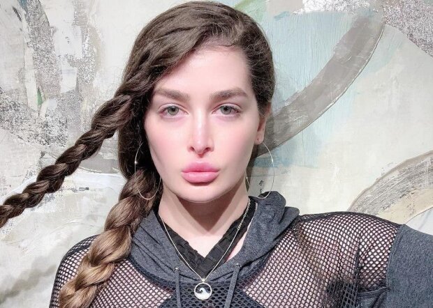 Дівчина видалила ребра і перекроїла обличчя за $187 тисяч – ось як тепер вона виглядає