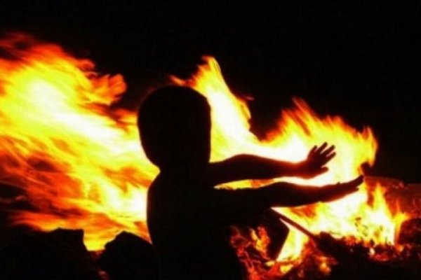 Зашивають штучною шкірою, накачали снодійним, щоб не конала: бабуся спалила заживо 3-річну внучку, в останній момент врятували сусіди (відео)