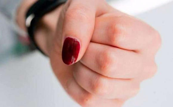 Стогін дитини чує весь будинок: матір жорстоко знущається з 7-річної доньки-інваліда, поліція спускає все на гальмах