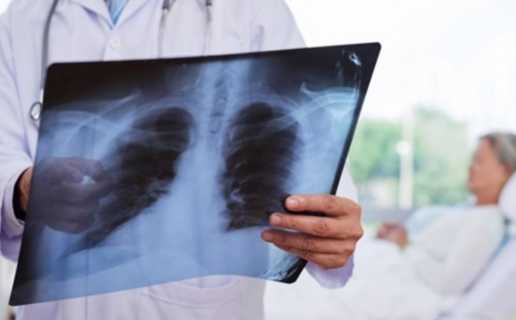 Симптом, який свідчить про ураження легенів при коронавірусі