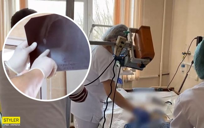 Під Вінницею трирічний малюк перестав ходити і говорити після COVID-19