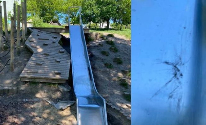 У Рівному хлопчику відрізало палець, коли він спускався з гірки на дитячому майданчику