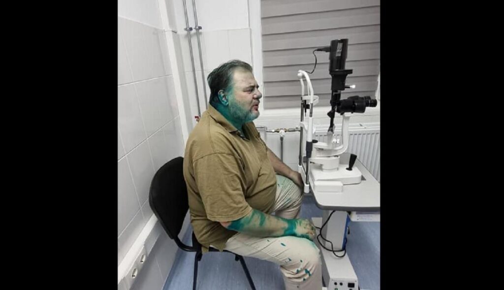 У Франківську ведучого “каналу Медведчука” облили зеленкою. Відео