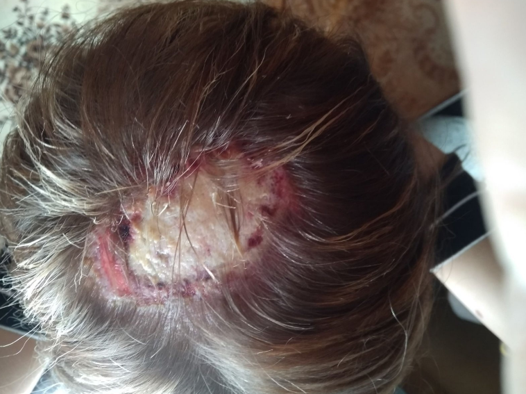 Хотіла бути красивою, а ледь не позбулася скальпа у перукаря: під Рівним розгорається скандал
