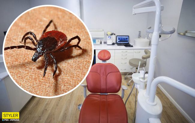 Біля Сум стоматолог під пломбою виявив кліща, який заразив жінку хворобою Лайма (фото)