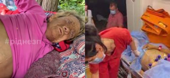 З травмою ніг вмирала на вулиці: жінка майже місяць лежала під деревом і просила допомоги (відео).