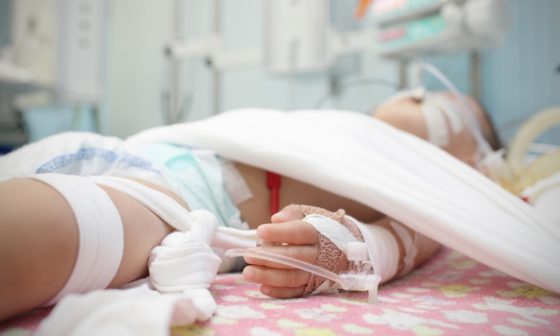 Дівчинка гралася з сірниками та підпалила на собі одяг: за життя дитини борються медики