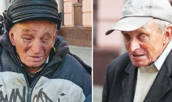 “Пане, дайте пару копійок”: Відомого франківського жебрака зі “стометрівки” знову побили (ФОТО)