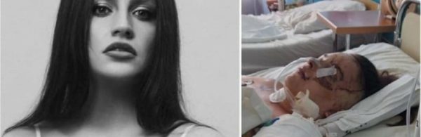 “Боротьба за повноцінне життя”: дівчина із Кременця, що постраждала у ДТП, потребує допомоги небайдужих