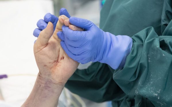 Ознаки затяжного COVID і його наслідки: лікарі назвали 7 головних симптомів