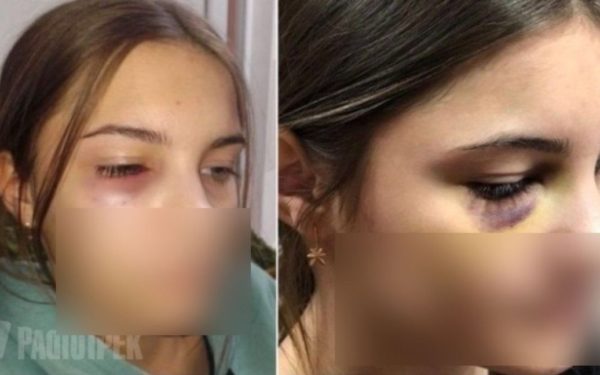 Лупцював, повалив на землю та копав: у Рівному в школі учень 7 класу жорстоко побив 13-річну дівчину