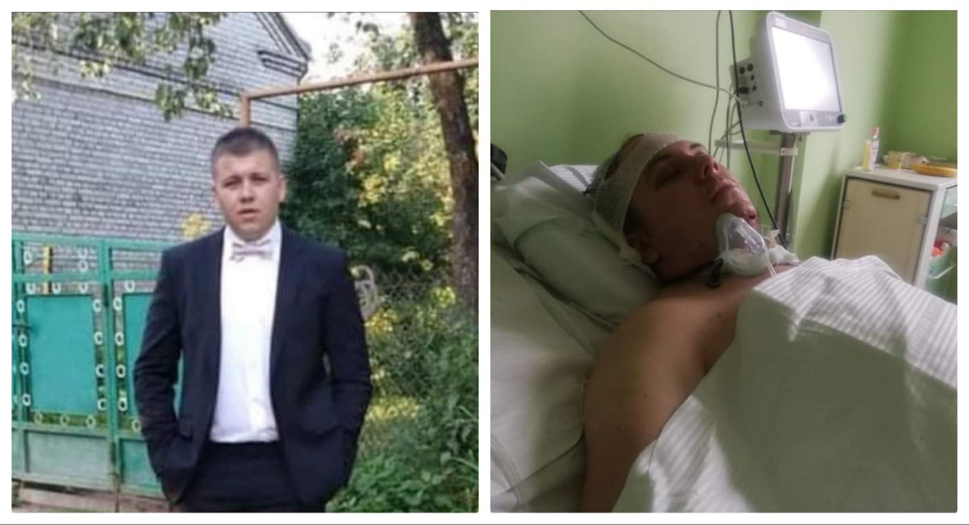 “Пірнув у річку і пошкодив хребет”: допомоги потребує паралізований хлопець з Львівщини