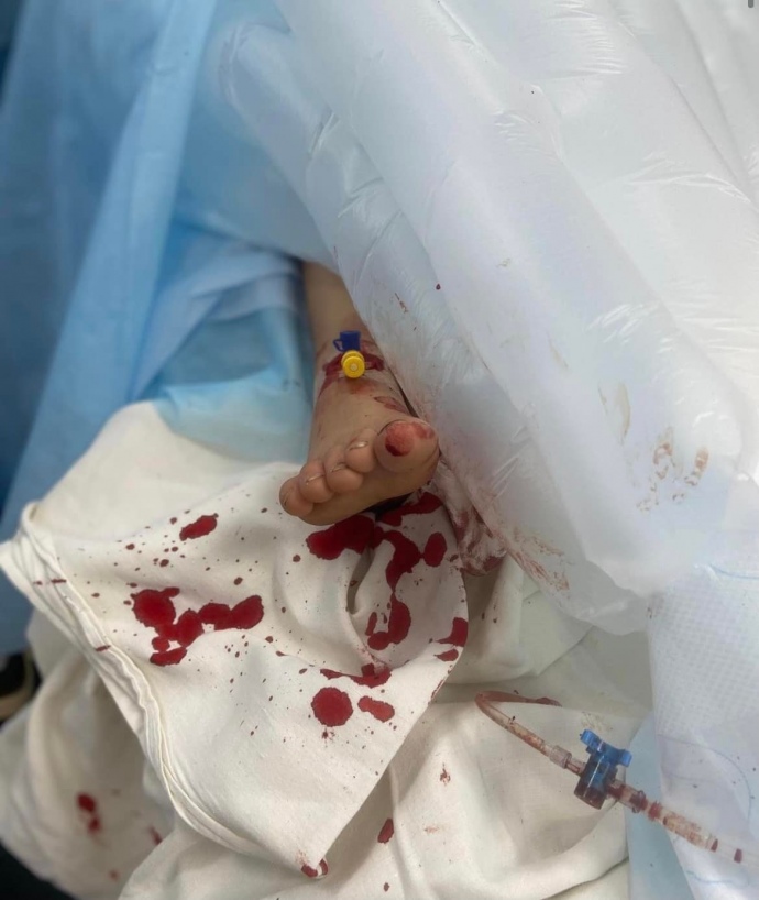 Ляшко: Загарбники вбили 198 цивільних, з них — 3 дітей