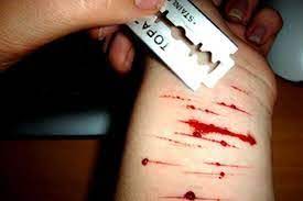 Витягли з того світу: у Дніпрі підліток просто під час навчання порізав собі руки