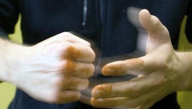 Бійка під нічним клубом у Франківську: травмованому рятують життя медики