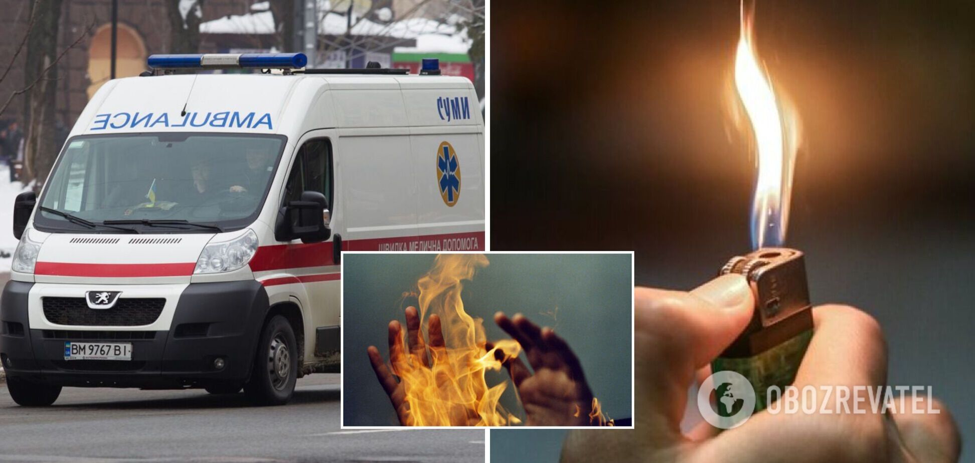 У Кривому Розі чоловік підпалив дівчину після сварки: з’ясувалися деталі трагедії. Фото