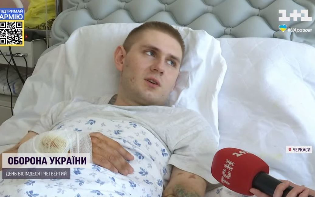 Під Ізюмом боєць вижив після підриву на міні, але втратив обидві ноги і руку