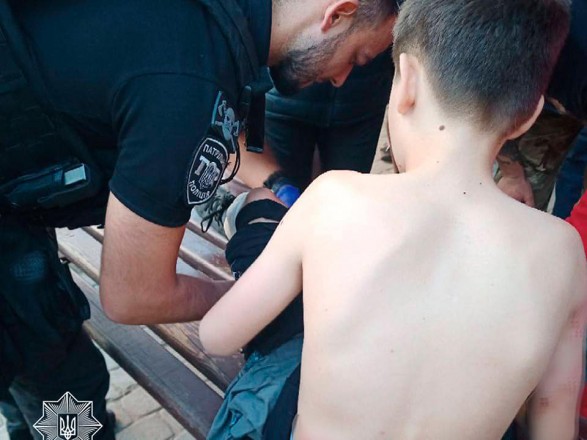 Укуси були на спині і на ногах: у Житомирі на 12-річного хлопчика напали вуличні собаки