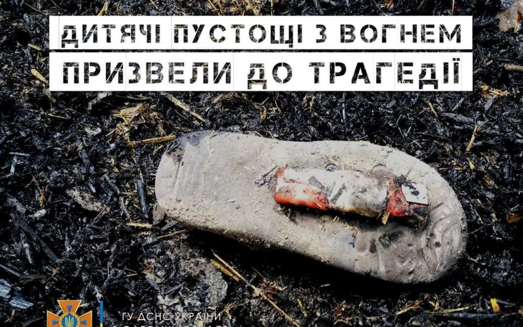 Пустощі призвели до трагедії: в Одесі помер маленький хлопчик, в якого обгоріло 98% тіла