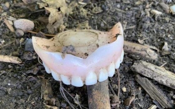 Так втікали, що зуби втратили: у Мережі оприлюднили фото покинутих позицій окупантів