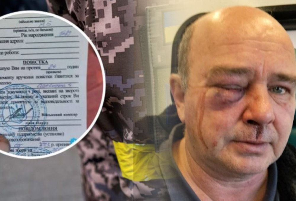 Чоловік у лікарні зі струсом мозку: працівники ТЦК побили водія фури, погрожували зброєю